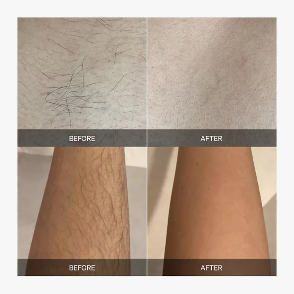 Silkaire™ — Effortless, Pain-Free Smooth Skin That Lasts and Glows