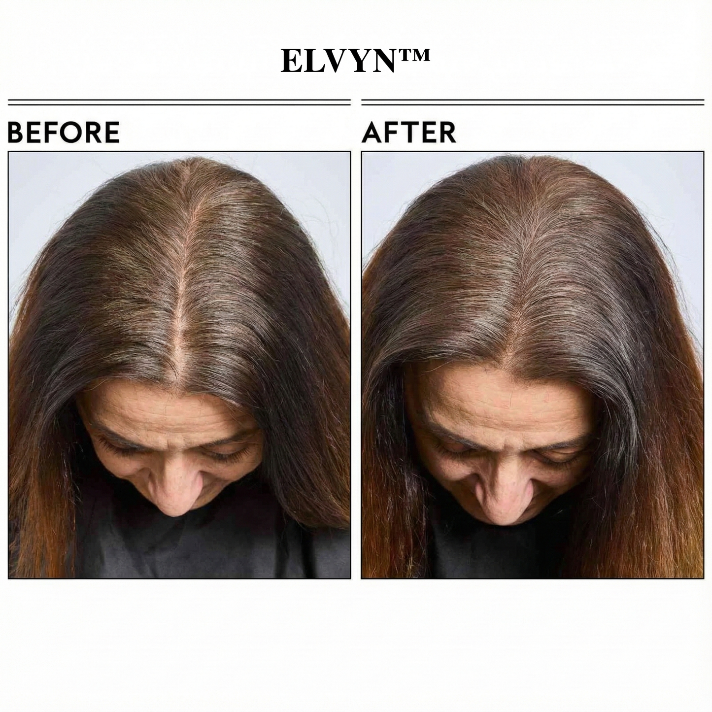 VividMist™ — Instantly Reclaim a Fuller, Younger-Looking Hairline Without the Wait