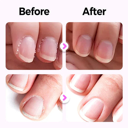 VeraNail™ Precision Pen — Transform Weak, Cracked Nails into Silky-Strong Gems You’ll Flaunt Proudly