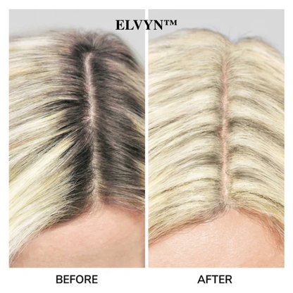 VividMist™ — Instantly Reclaim a Fuller, Younger-Looking Hairline Without the Wait