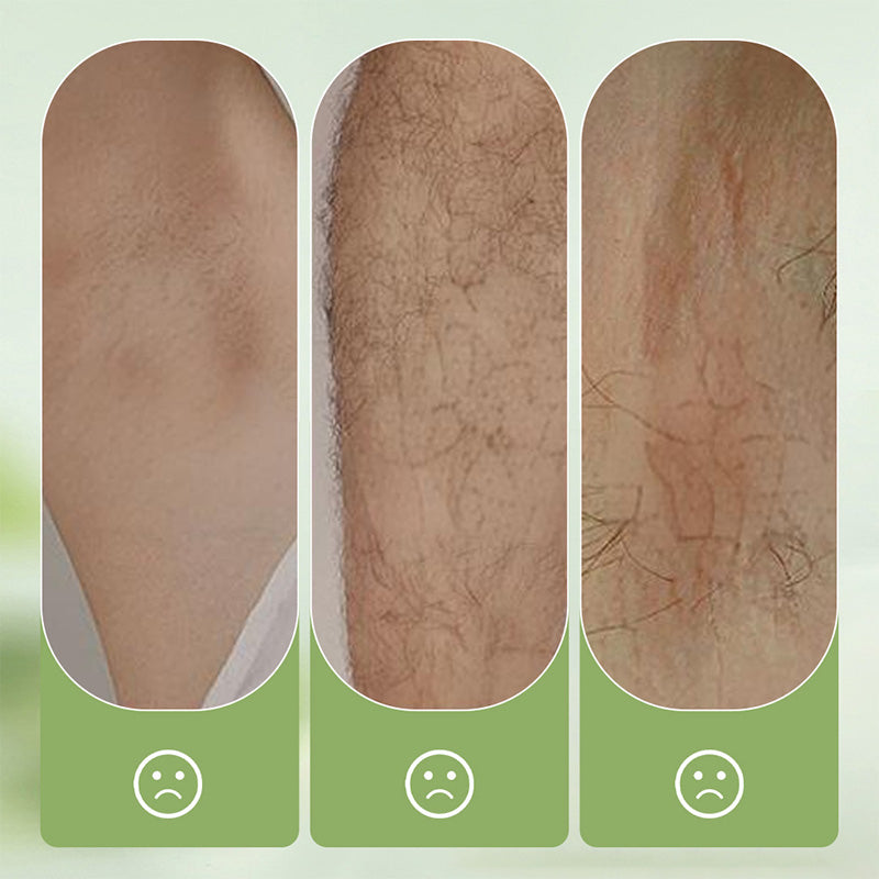 Velvessa™ — Unleash Silky Smooth Skin with Zero Pain and Instant Confidence