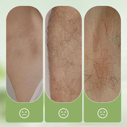 Velvessa™ — Unleash Silky Smooth Skin with Zero Pain and Instant Confidence