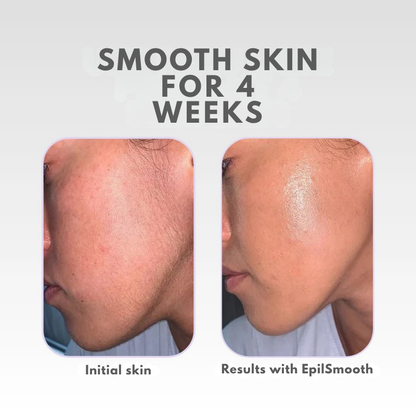 LuxeSmooth™ — Unlock Weeks of Silky-Smooth, Irritation-Free Radiance