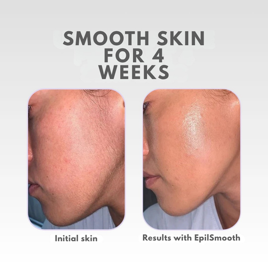 LuxeSmooth™ — Unlock Weeks of Silky-Smooth, Irritation-Free Radiance