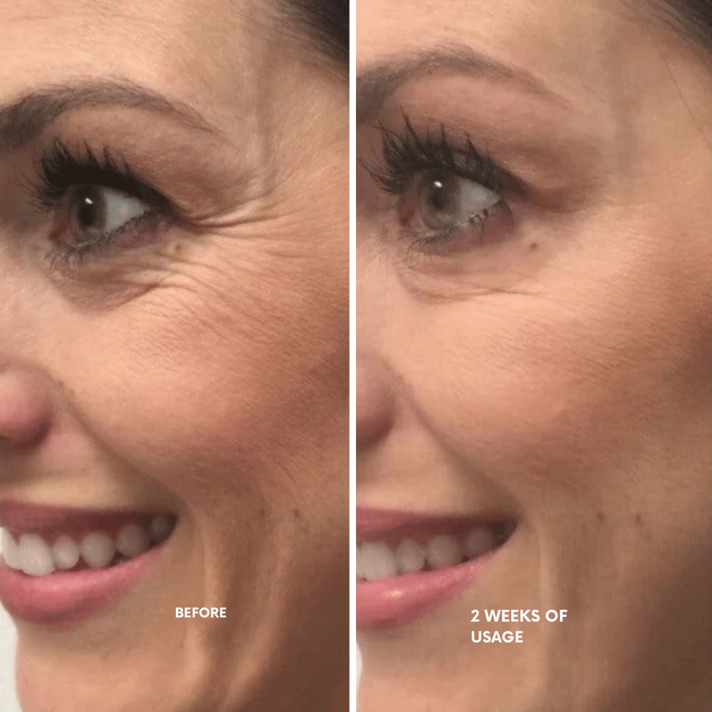 RadianceRush™ Retinal Serum — Unleash Silky, Youthful Skin That Commands Attention