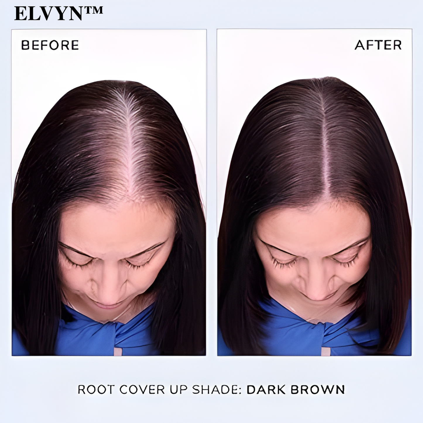 VividMist™ — Instantly Reclaim a Fuller, Younger-Looking Hairline Without the Wait