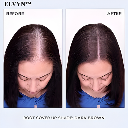 VividMist™ — Instantly Reclaim a Fuller, Younger-Looking Hairline Without the Wait