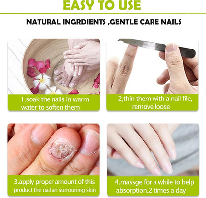 VitaShield™ Nail Renew Gel — Unlock Bold, Beautiful Nails That Command Attention