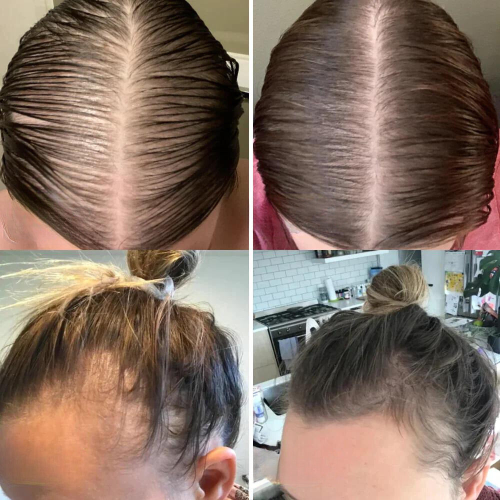 LuxaGrow™ — Unlock Thick, Radiant Hair That Commands Attention Every Day