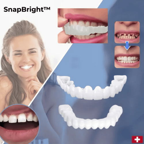 SmileFlex™ — Unleash a Stunning, Effortless Smile That Transforms Your Confidence Instantly