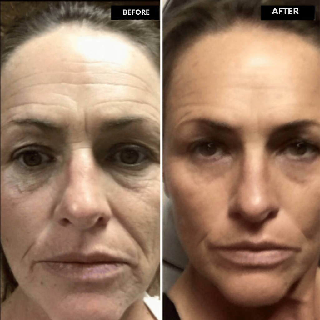 RadianceRush™ Retinal Serum — Unleash Silky, Youthful Skin That Commands Attention
