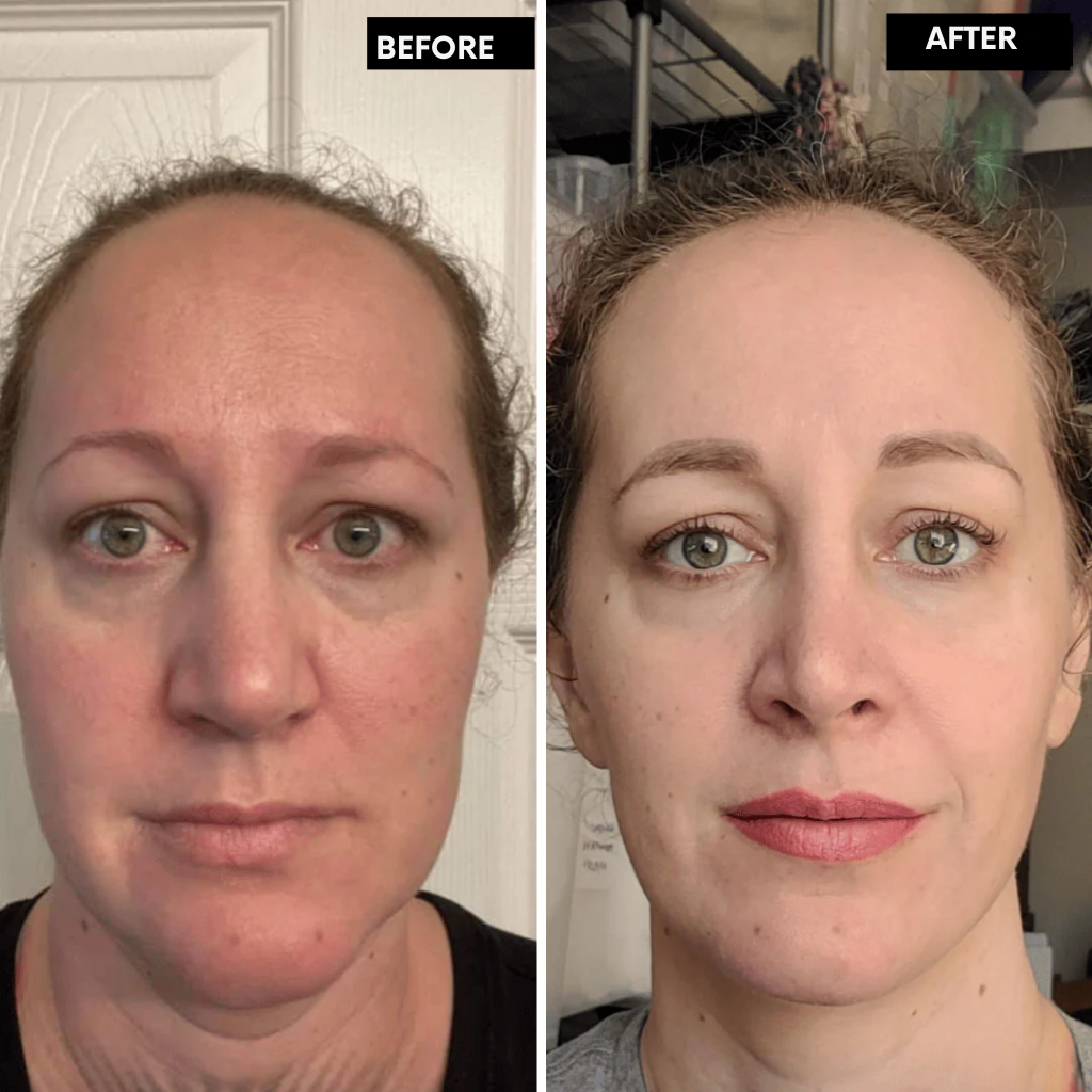 RadianceRush™ Retinal Serum — Unleash Silky, Youthful Skin That Commands Attention
