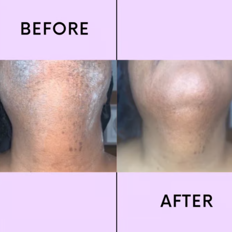 LumaSoothe™ — Feel the Freedom of Silky, Pain-Free Smoothness Instantly