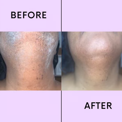 LumaSoothe™ — Feel the Freedom of Silky, Pain-Free Smoothness Instantly