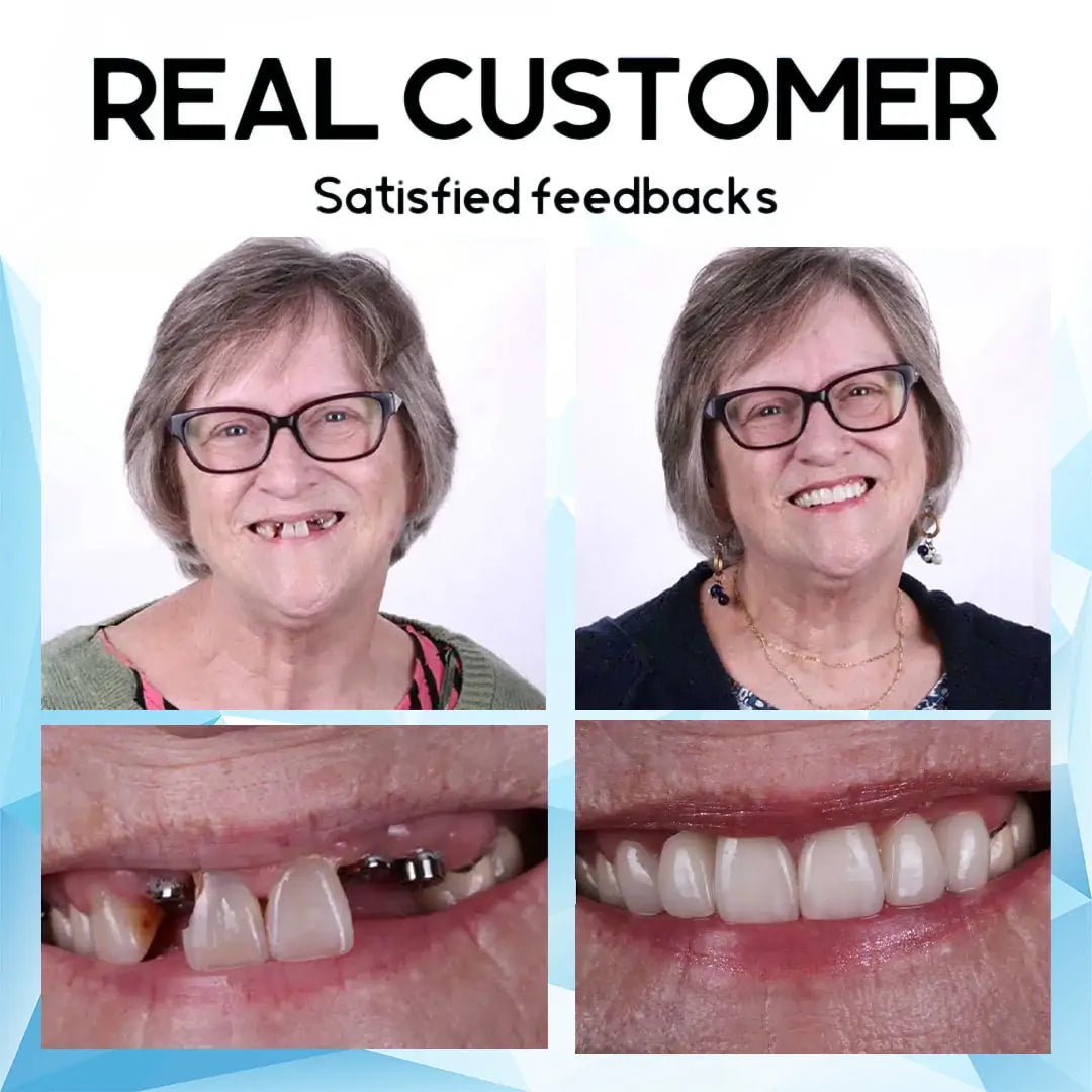 LunaSmile™ — Unlock Effortless Confidence with a Natural, Pain-Free Smile