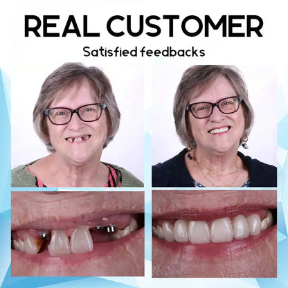 LunaSmile™ — Unlock Effortless Confidence with a Natural, Pain-Free Smile