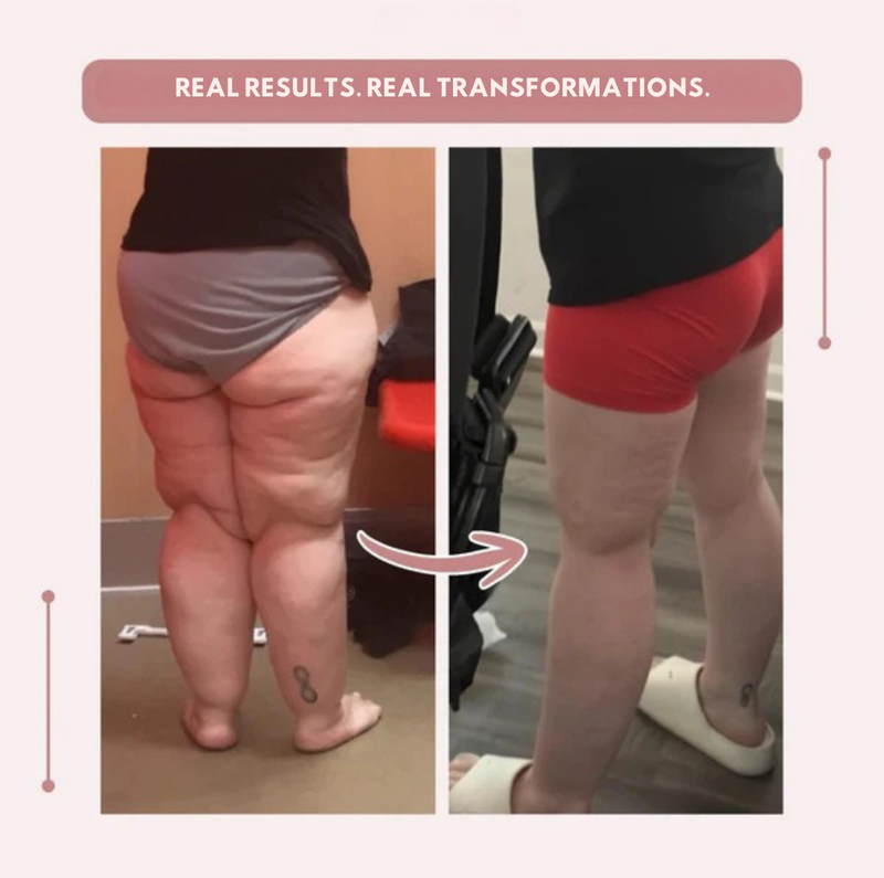 VeinVive™ — Energize Your Legs with All-Day Comfort and Confidence