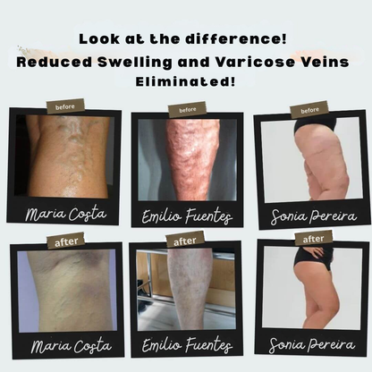 RevitaStride™ — Unlock All-Day Energy and Banished Leg Pain Instantly