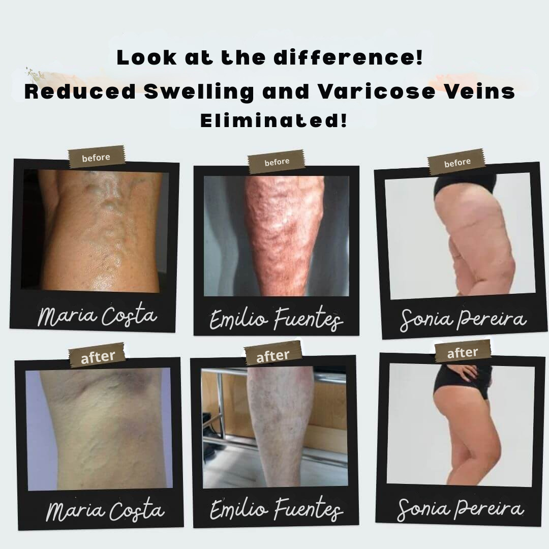 GlideFlow™ — Instantly Lighten Aching Legs with Soothing Warmth and Power