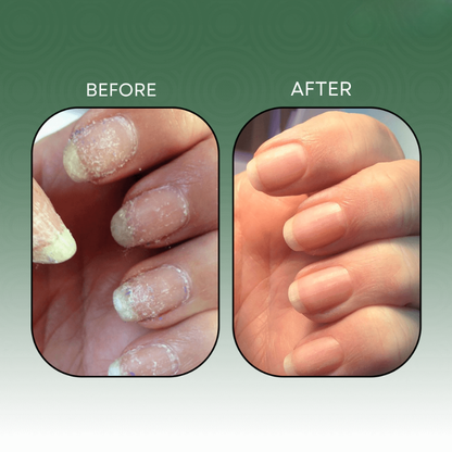 EverBeau™ — Unleash Nails That Command Attention with Unbreakable Strength and Shine