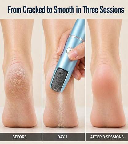 RadiantStep™ — Unlock Silky, Sandal-Ready Feet in Just Minutes Without Pain or Fuss