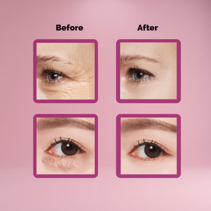 EyeVive™ — Transform Tired Eyes Into a Youthful, Radiant Glow Instantly