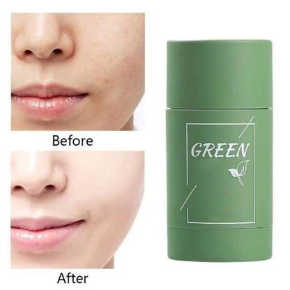 Virella™ Detox Mask Stick — Unlock Radiant, Shine-Free Skin That Commands Attention