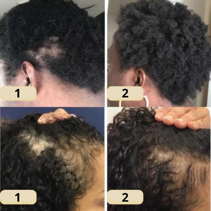 PureVeil™ — Ignite Your Scalp, Unlock Thicker, Fuller Hair That Turns Heads