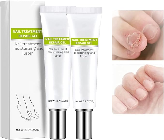 VitaShield™ Nail Renew Gel — Unlock Bold, Beautiful Nails That Command Attention