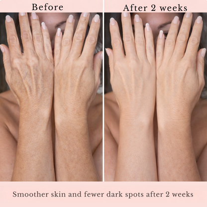 RadiantFlex™ Body Renewal Serum — Unlock Firmer, Smoother Skin That Makes You Glow with Confidence