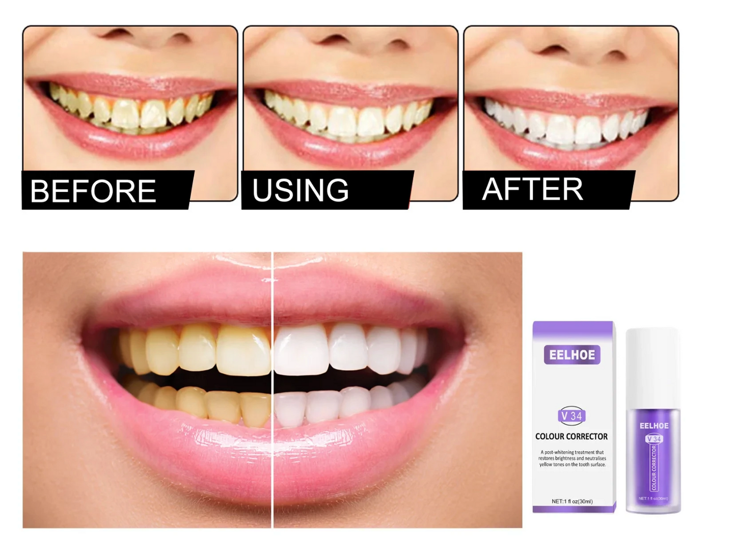 RadiantBeam™ — Instantly Brighten Your Smile Without Pain or Wait