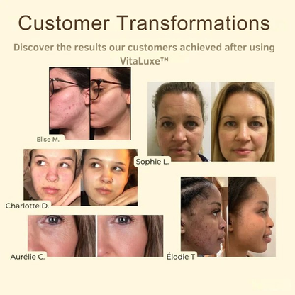 RadianceRush™ Detox Mask — Unleash Clear, Glowing Skin That Commands Confidence