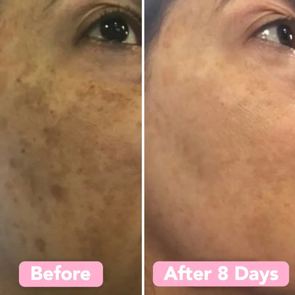 RadiantWink™ Elixir Pads — Wake Up to a Stunning, Spotless Glow That Turns Heads