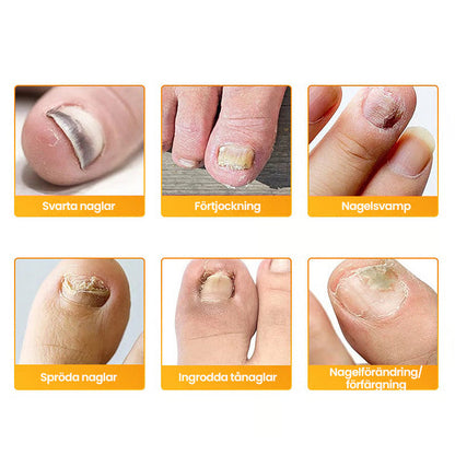 NailGuard Pro™ — Step Into Confidence with Nails That Shine Clear and Strong