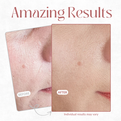LumaLift™ — Unlock Instant Radiance and Unshakable Confidence