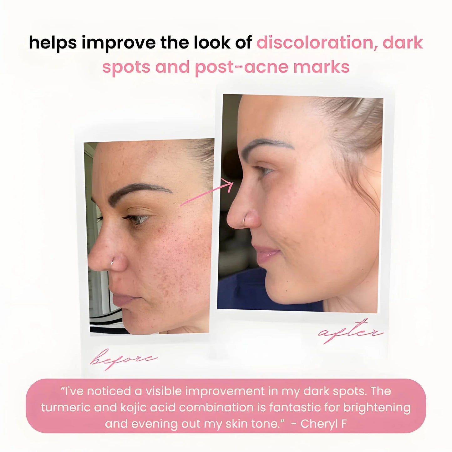 RadiantWink™ Elixir Pads — Wake Up to a Stunning, Spotless Glow That Turns Heads
