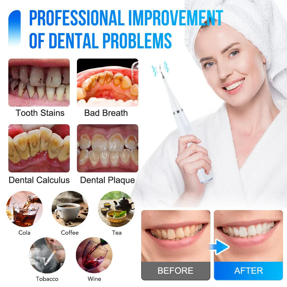LumaPulse™ — Unlock a Radiant Smile That Commands Every Room
