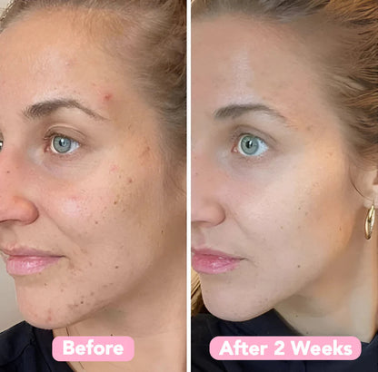 RadiantWink™ Elixir Pads — Wake Up to a Stunning, Spotless Glow That Turns Heads