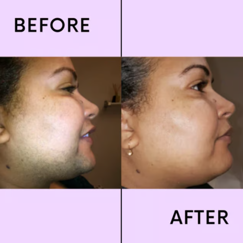 Velarra™ — Reveal Silky, Radiant Skin Without Pain or Irritation Every Time