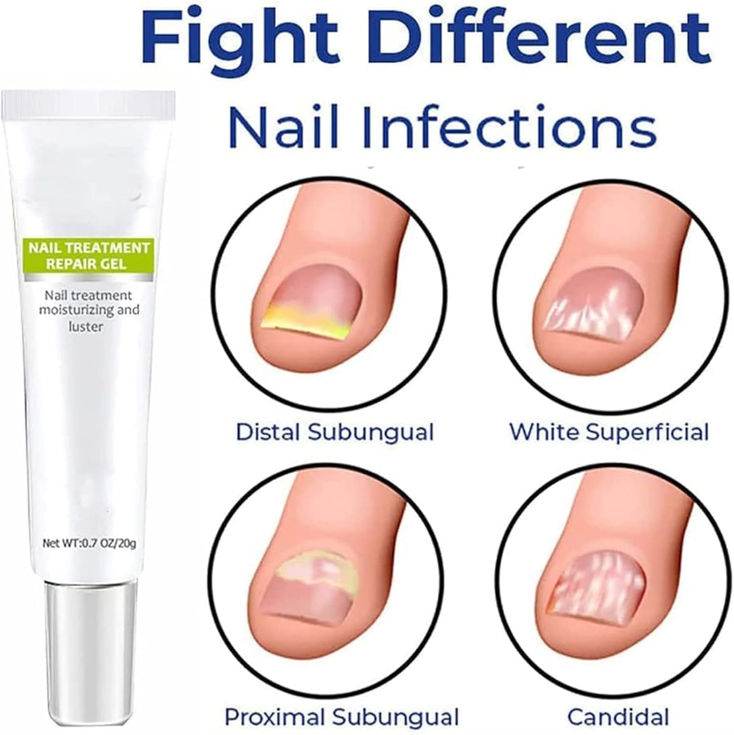 VitaShield™ Nail Renew Gel — Unlock Bold, Beautiful Nails That Command Attention
