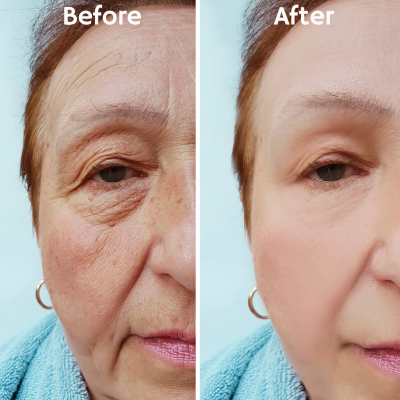 LumiraLift™ — Instantly Firm, Glow, and Transform Your Skin’s Youthful Spark