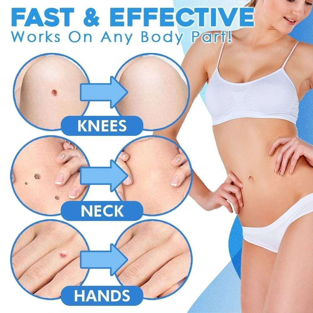 LumaClear™ — Reveal Smooth, Flawless Skin Fast Without Pain or Scars