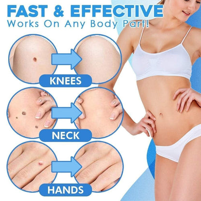 LumaClear™ — Reveal Smooth, Flawless Skin Fast Without Pain or Scars