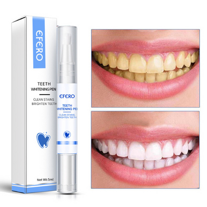 GlowWhiten | Teeth Whitener