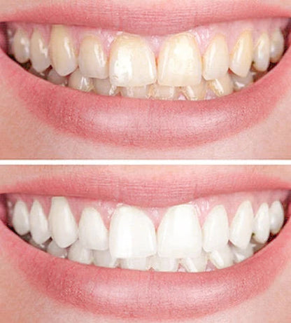 RadiancePulse™ — Unleash a Radiant, Pain-Free Smile That Commands Attention