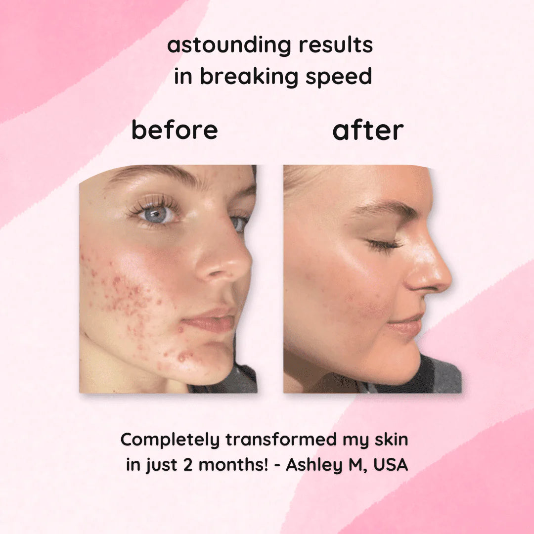 RadiantWink™ Elixir Pads — Wake Up to a Stunning, Spotless Glow That Turns Heads
