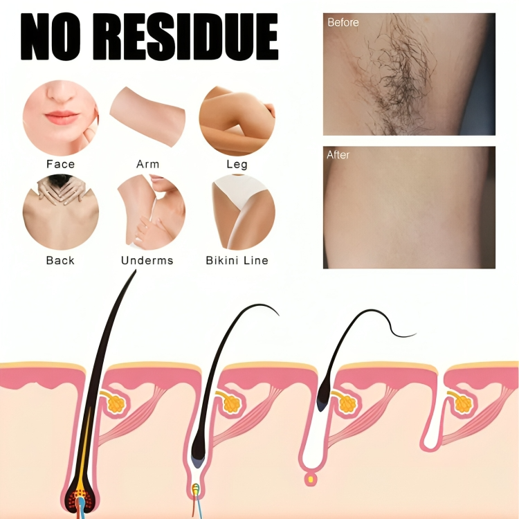 SilkEssence™ — Unleash Silky, Touchably Smooth Skin Without Pain or Irritation