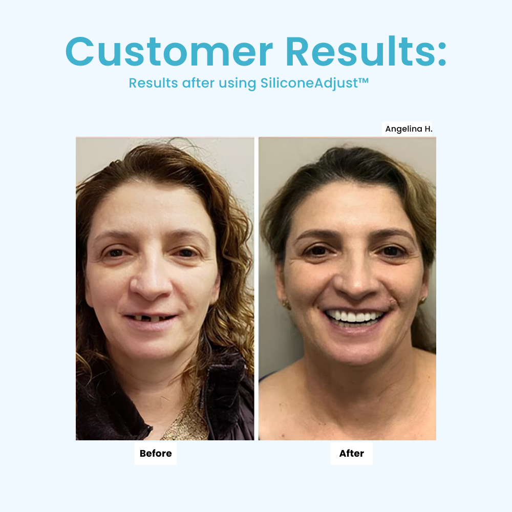 LumaFit™ Denture Cushion Set — Finally Enjoy Pain-Free Smiles That Fit Like They Were Made for You