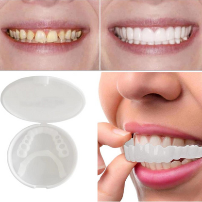 SmileFlex™ — Unleash a Stunning, Effortless Smile That Transforms Your Confidence Instantly