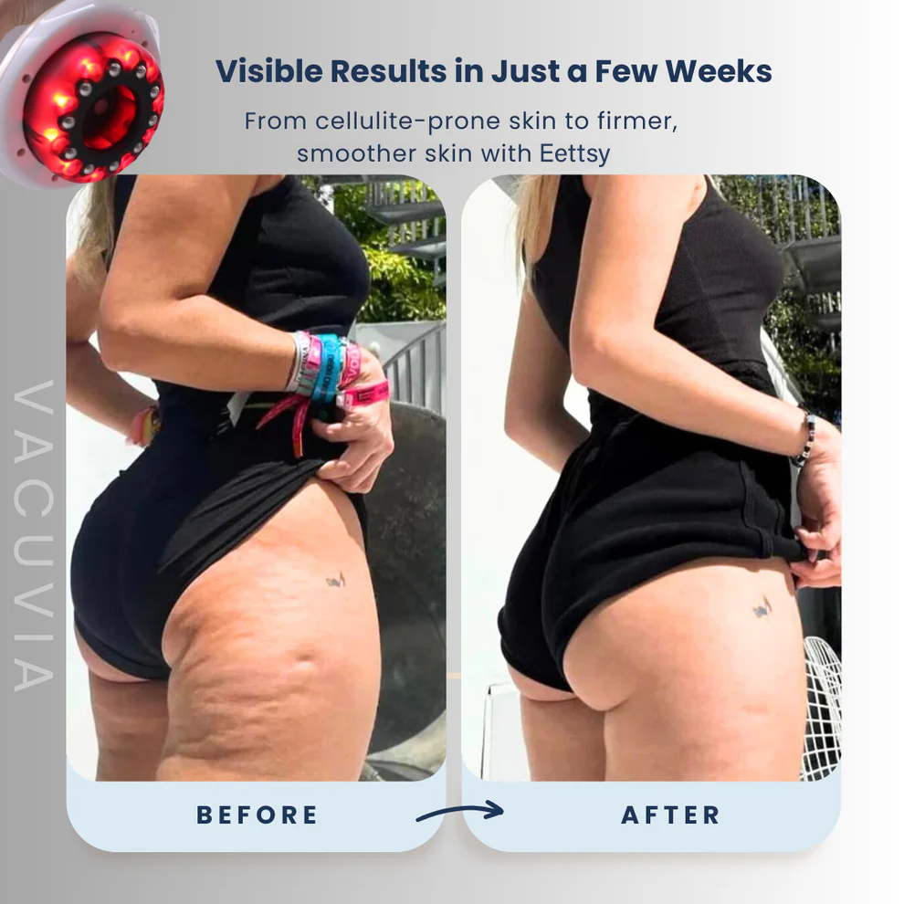 RadiancePulse™ — Unlock Silky, Sculpted Skin That Commands Confidence